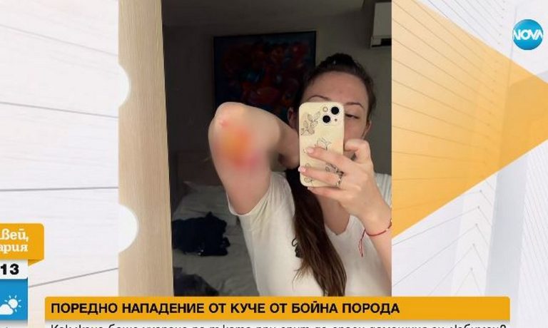 Kуче порода кане корсо нападна агресивно жена и домашното и куче (ВИДЕО)