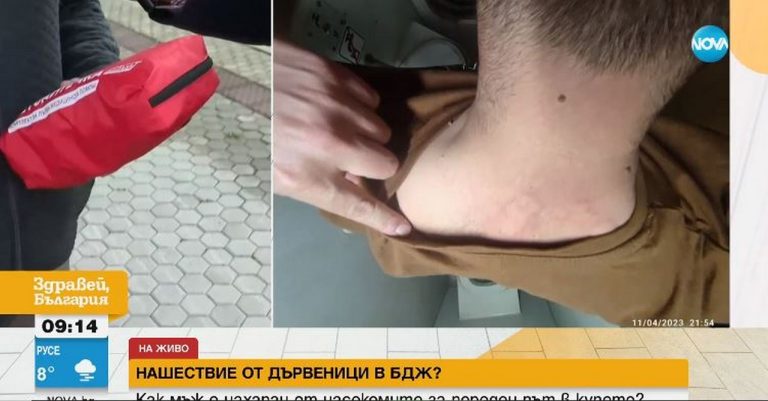 Мъж стига до анафилактичен шок след като е нахапан от дървеници във влака. Тази атака не е първи случай (ВИДЕО)